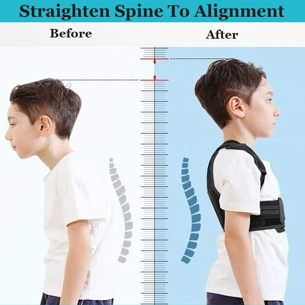 Professional Posture Corrector for Kids and Teens, Effective Upper Back Posture Brace for Teenagers Boys Girls Spinal Support to Improves Slouch, Prevent Humpback, Relieve Back Pain